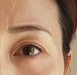 치유앤미 동안눈성형 이런 분들이 오십니다